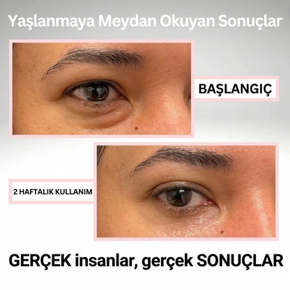 Dermalina | Zaman Silgisi